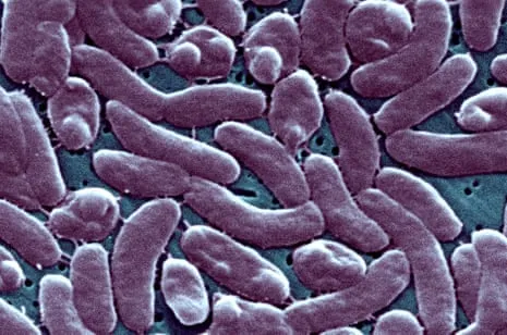 Louisiana Confirms Five Fatalities from Necrotizing Bacterium in Gulf Waters
